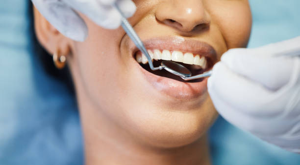 Best Emergency Treatment for Dental Infections or Abscesses in Bartlett, TN